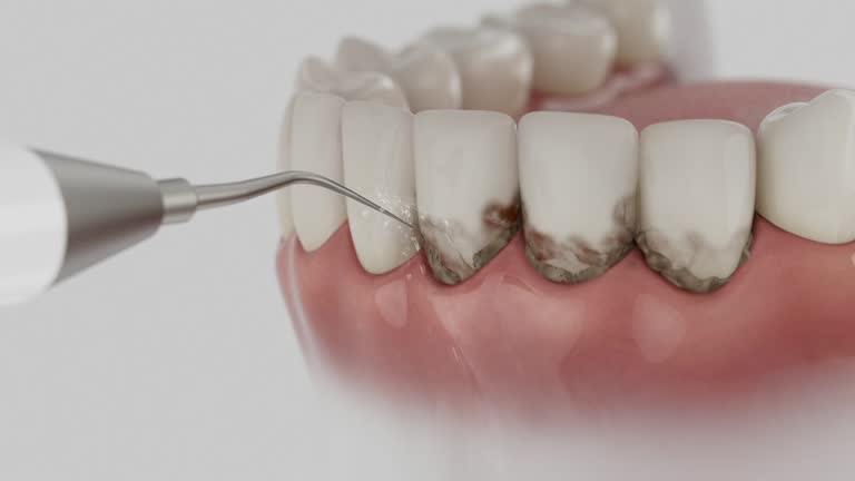 Trusted Emergency Dentist service in Saluda, SC - Dentist Open Now
